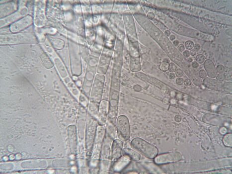 lactobacillus bacteria microscope probiotic culture