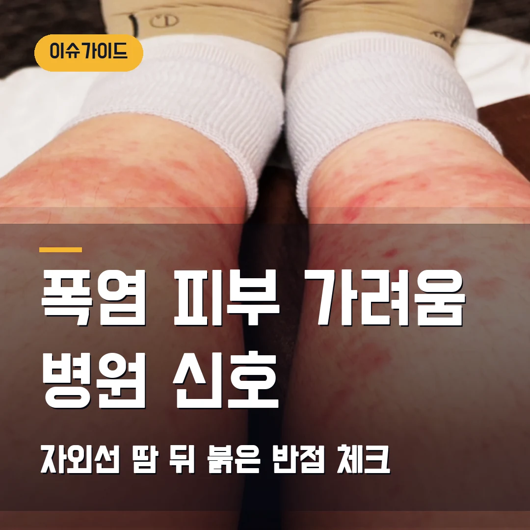 폭염 피부 가려움 2026 — 자외선·땀 뒤 붉은 반점, 병원 가야 할 신호